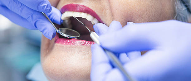 Best Emergency Cosmetic Dentistry (e.g., broken veneers) in Rugby, ND